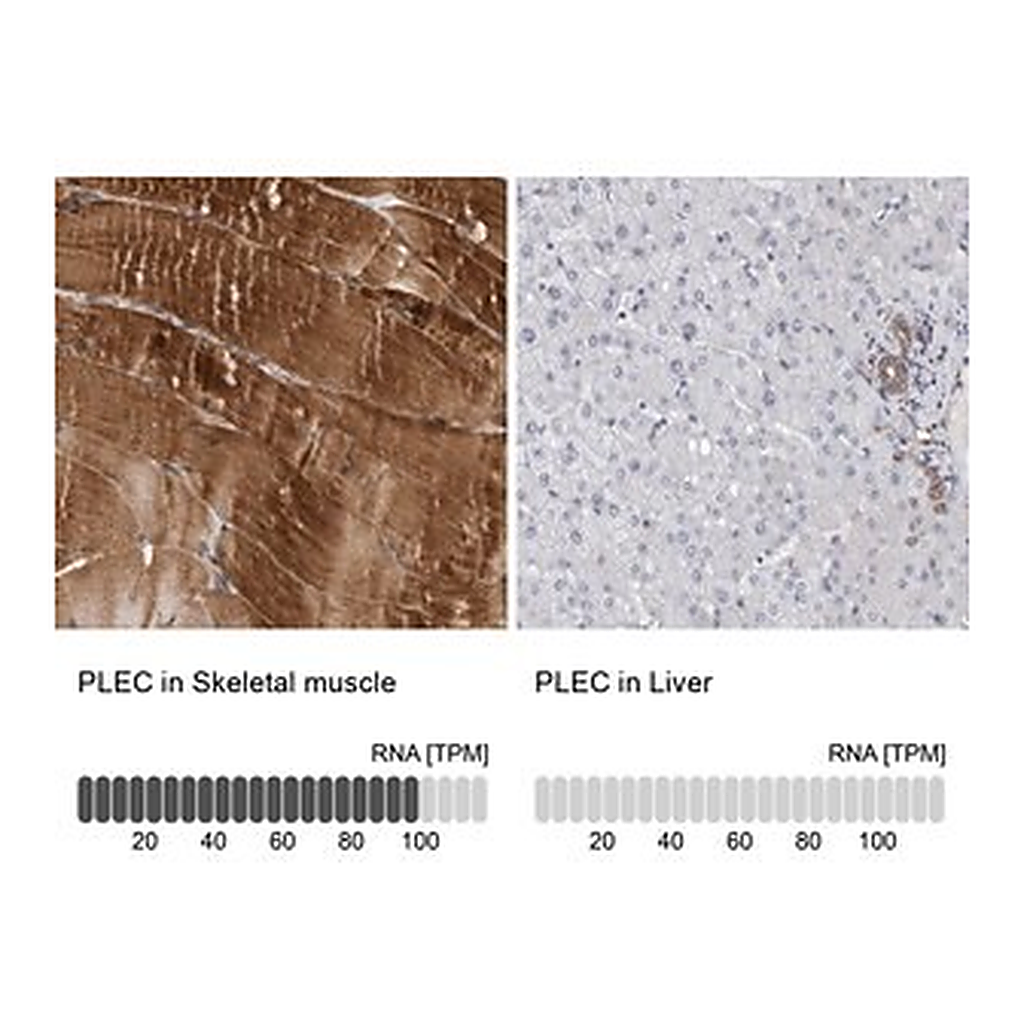 Merck Anti-PLEC antibody produced in rabbit