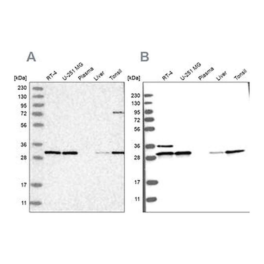 Merck Anti-RPA2 antibody produced in rabbit
