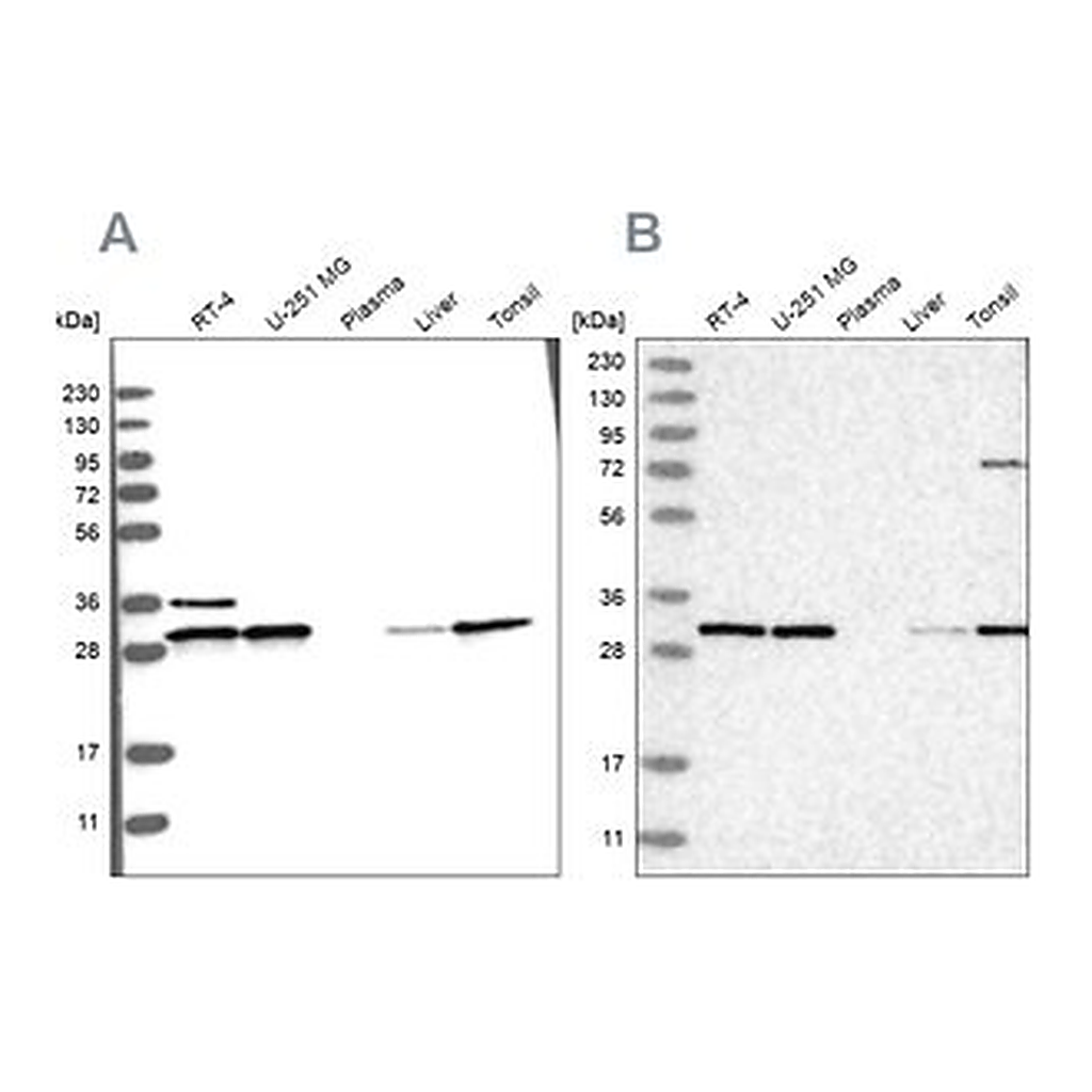 Merck Anti-RPA2 antibody produced in rabbit