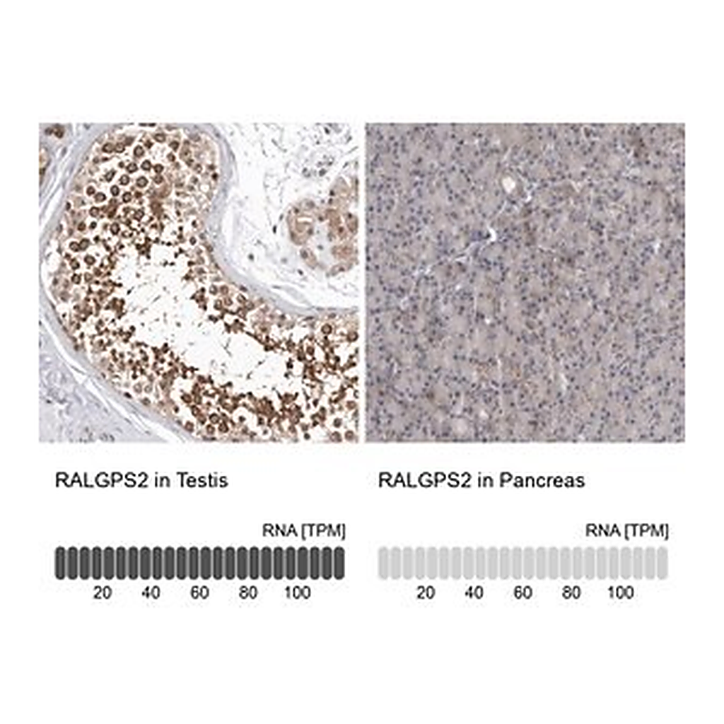 Merck Anti-RALGPS2 antibody produced in rabbit