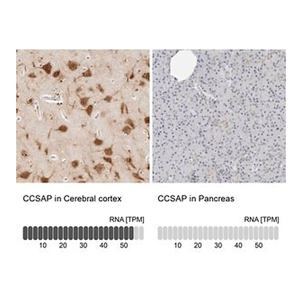 Merck Anti-CCSAP antibody produced in rabbit