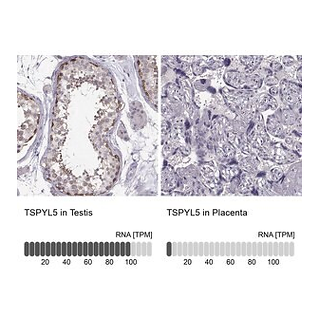 Merck Anti-TSPYL5 antibody produced in rabbit