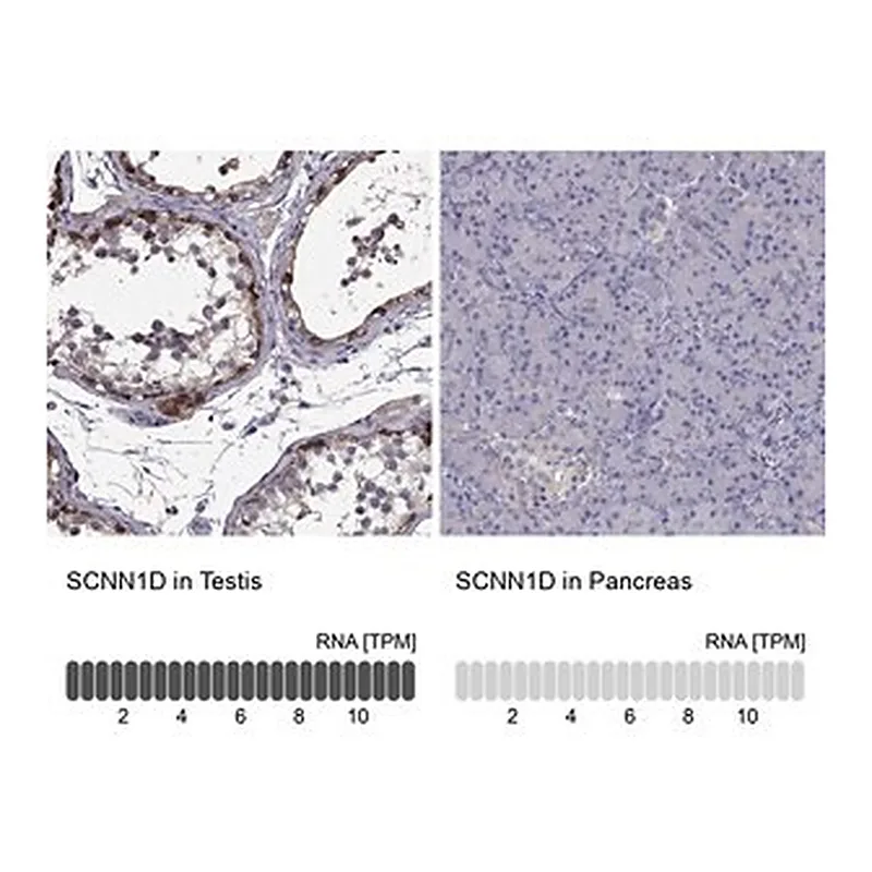 Merck Anti-SCNN1D antibody produced in rabbit