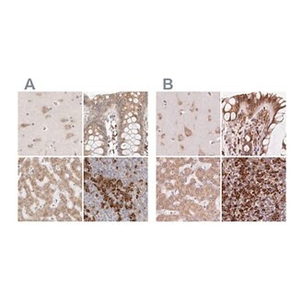 Merck Anti-RPN1 antibody produced in rabbit