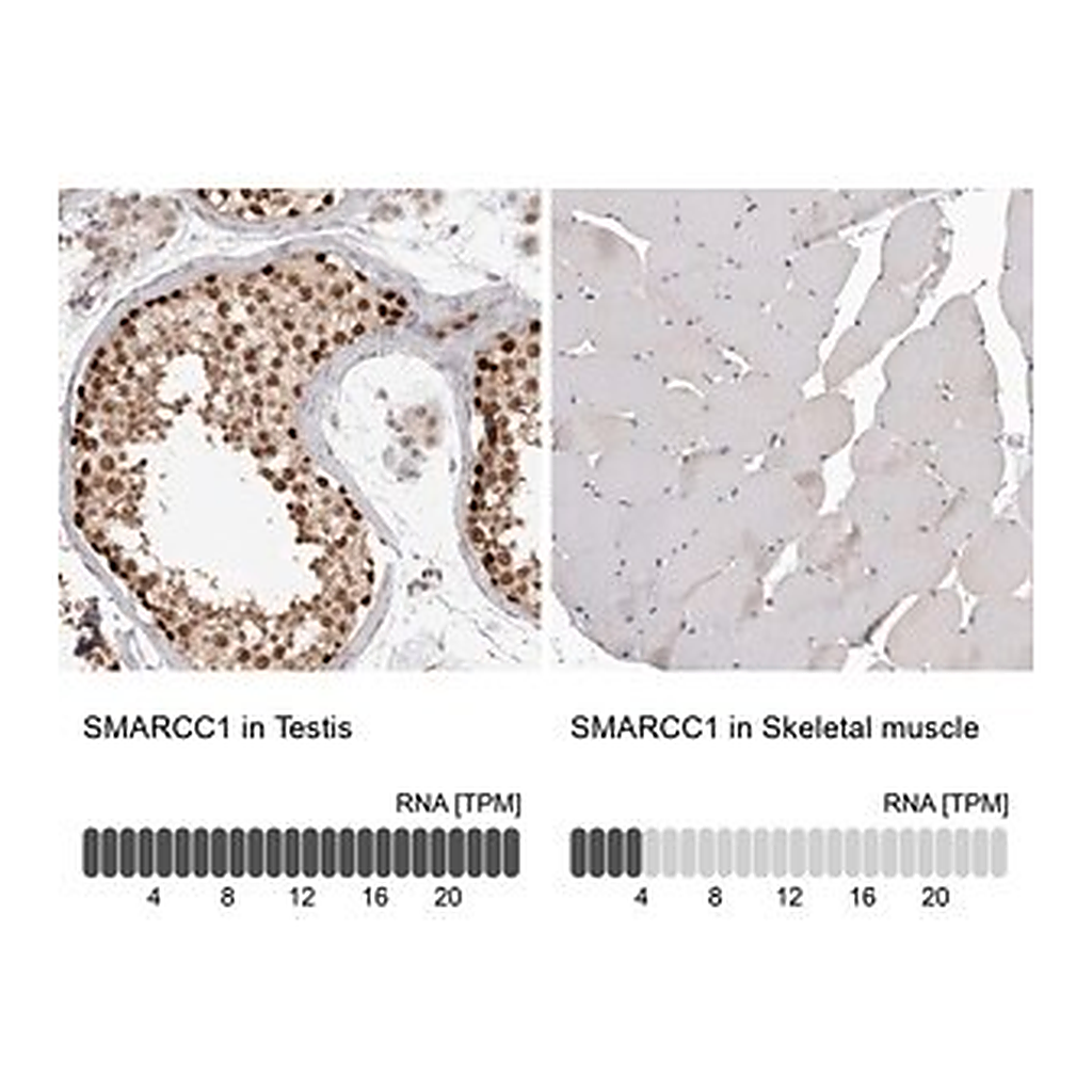 Merck Anti-SMARCC1 antibody produced in rabbit