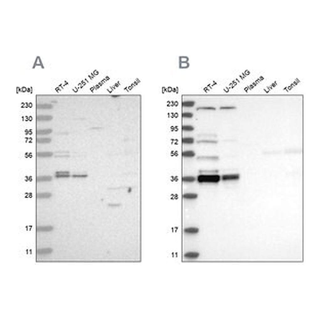 Merck Anti-C1orf131 antibody produced in rabbit