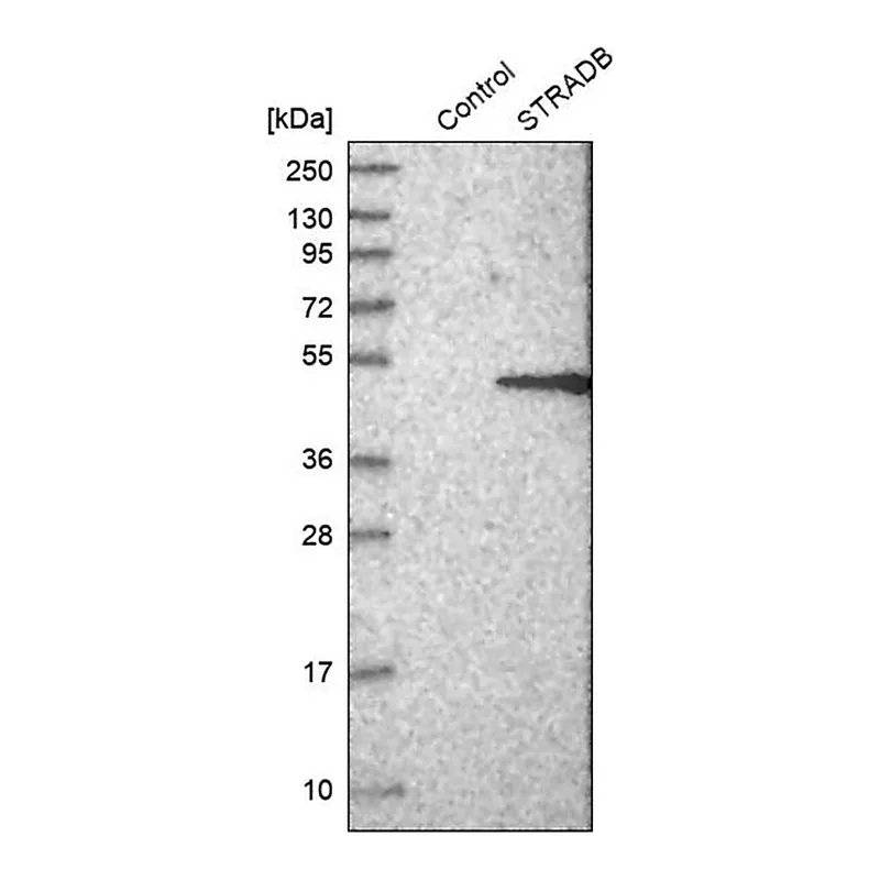 Merck Anti-STRADB antibody produced in rabbit