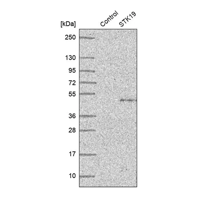 Merck Anti-STK19 antibody produced in rabbit