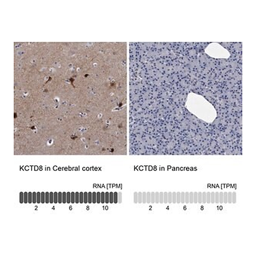 Merck Anti-KCTD8 antibody produced in rabbit
