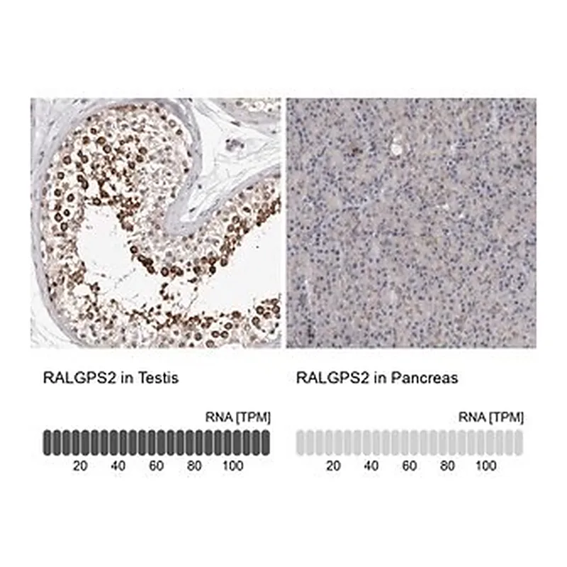 Merck Anti-RALGPS2 antibody produced in rabbit