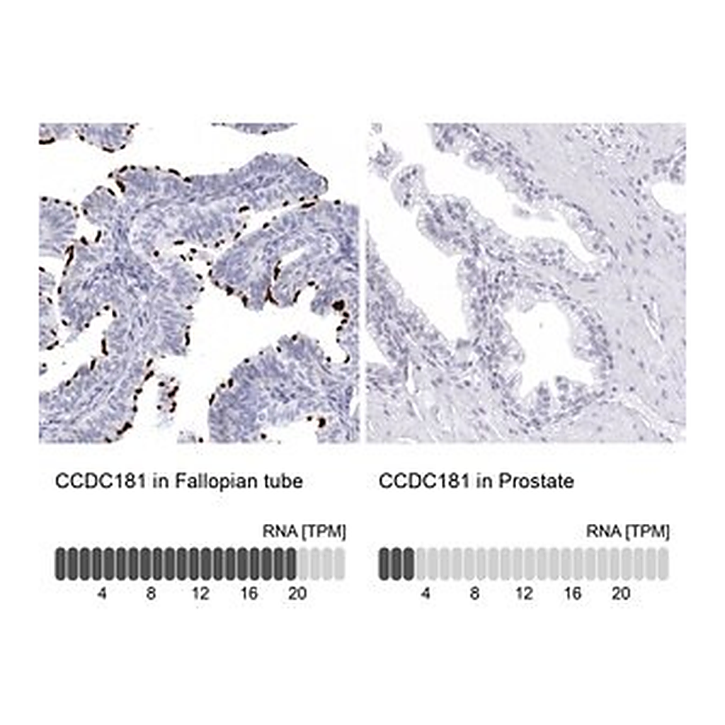 Merck Anti-CCDC181 antibody produced in rabbit
