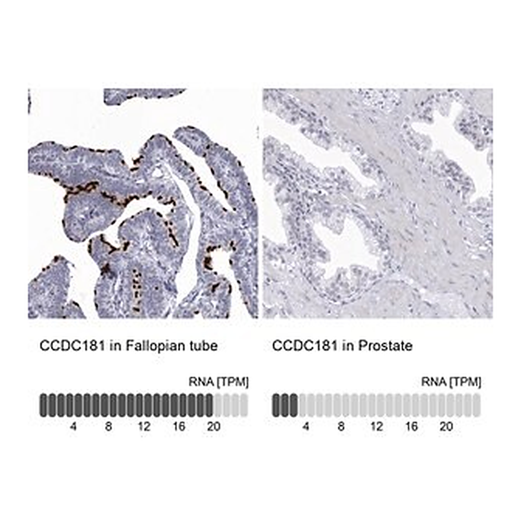 Merck Anti-CCDC181 antibody produced in rabbit