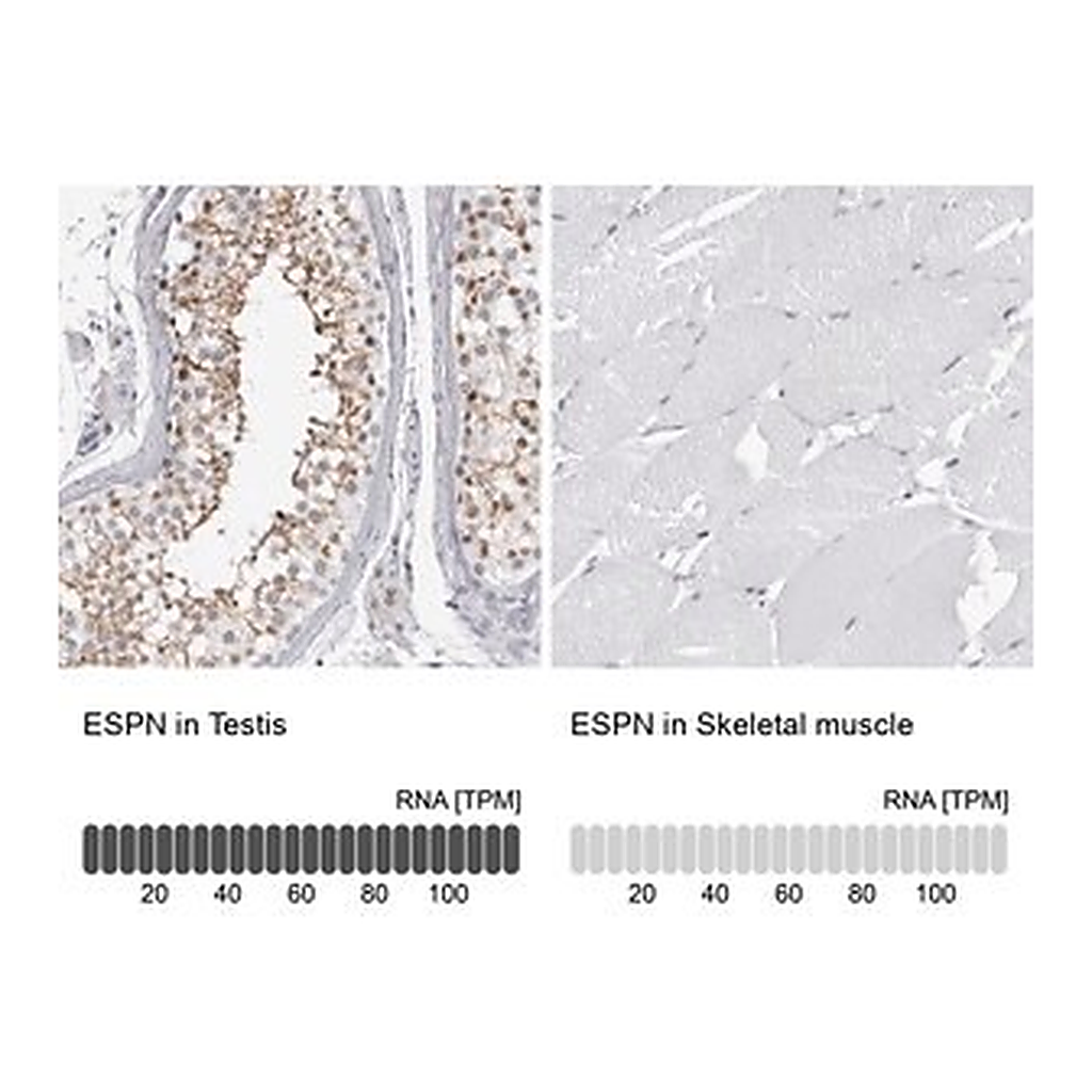 Merck Anti-ESPN antibody produced in rabbit