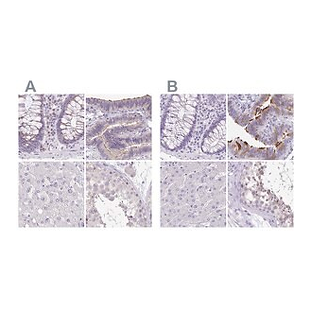Merck Anti-ANKRD45 antibody produced in rabbit