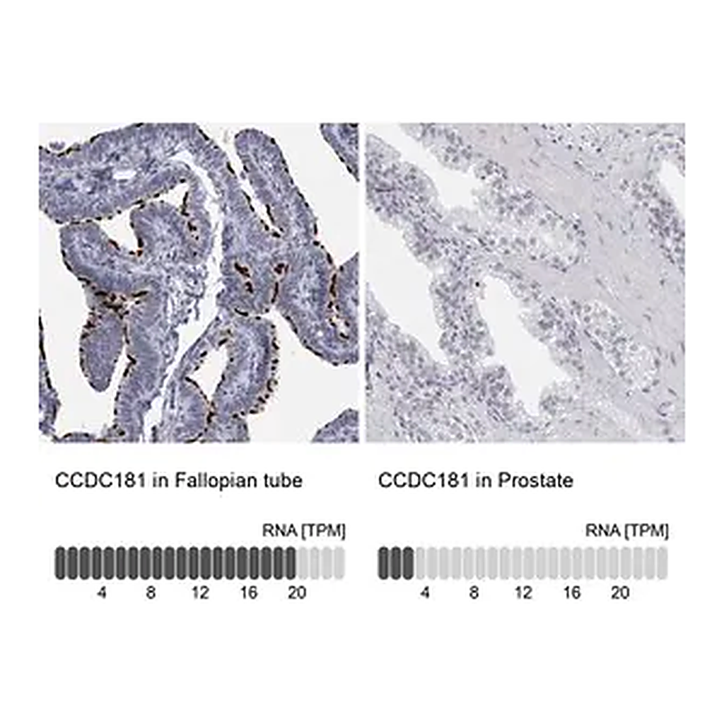 Merck Anti-CCDC181 antibody produced in rabbit