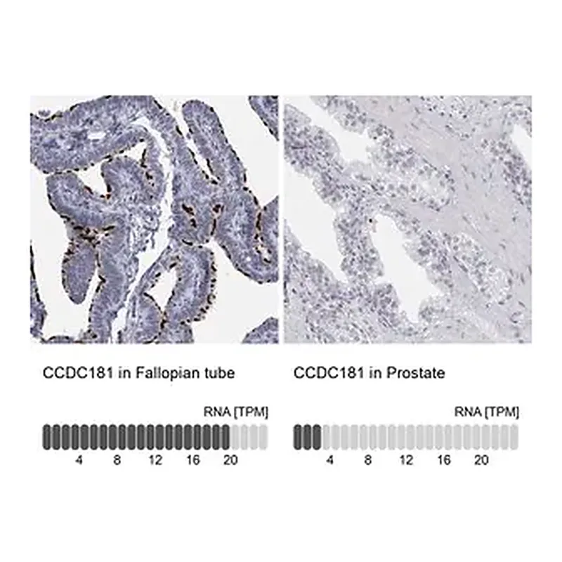 Merck Anti-CCDC181 antibody produced in rabbit