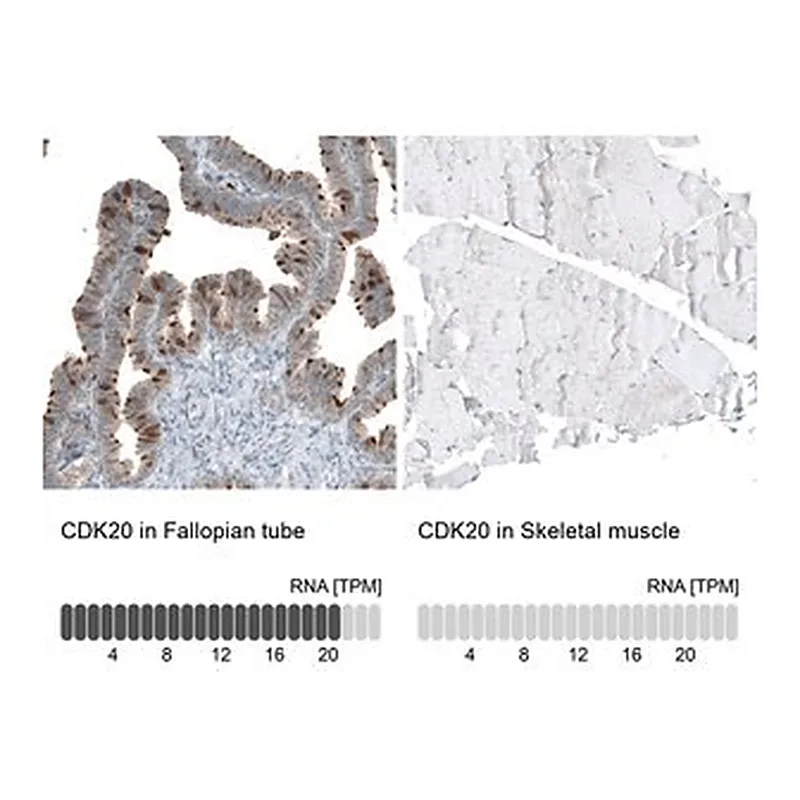 Merck Anti-CDK20 antibody produced in rabbit