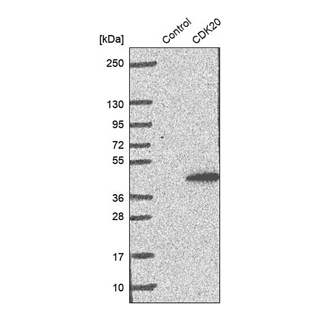 Merck Anti-CDK20 antibody produced in rabbit