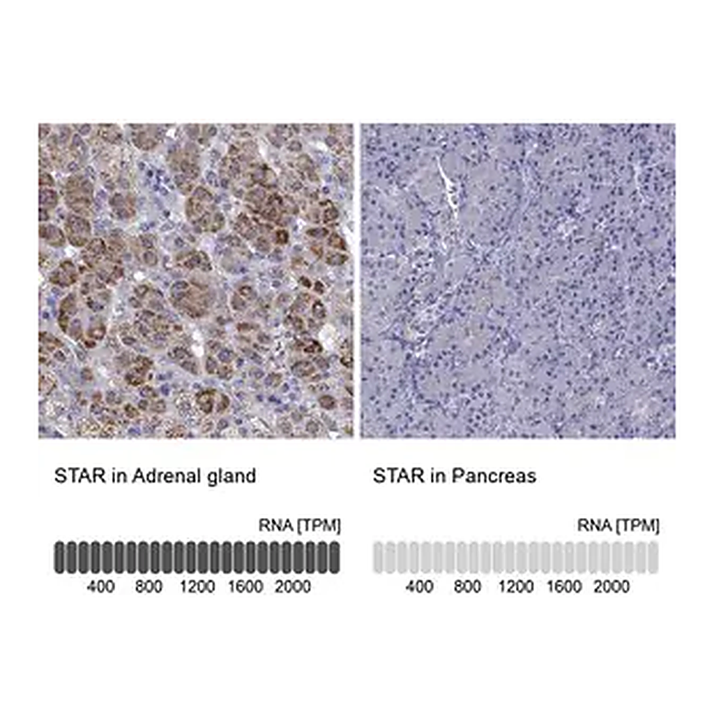 Merck Anti-STAR antibody produced in rabbit