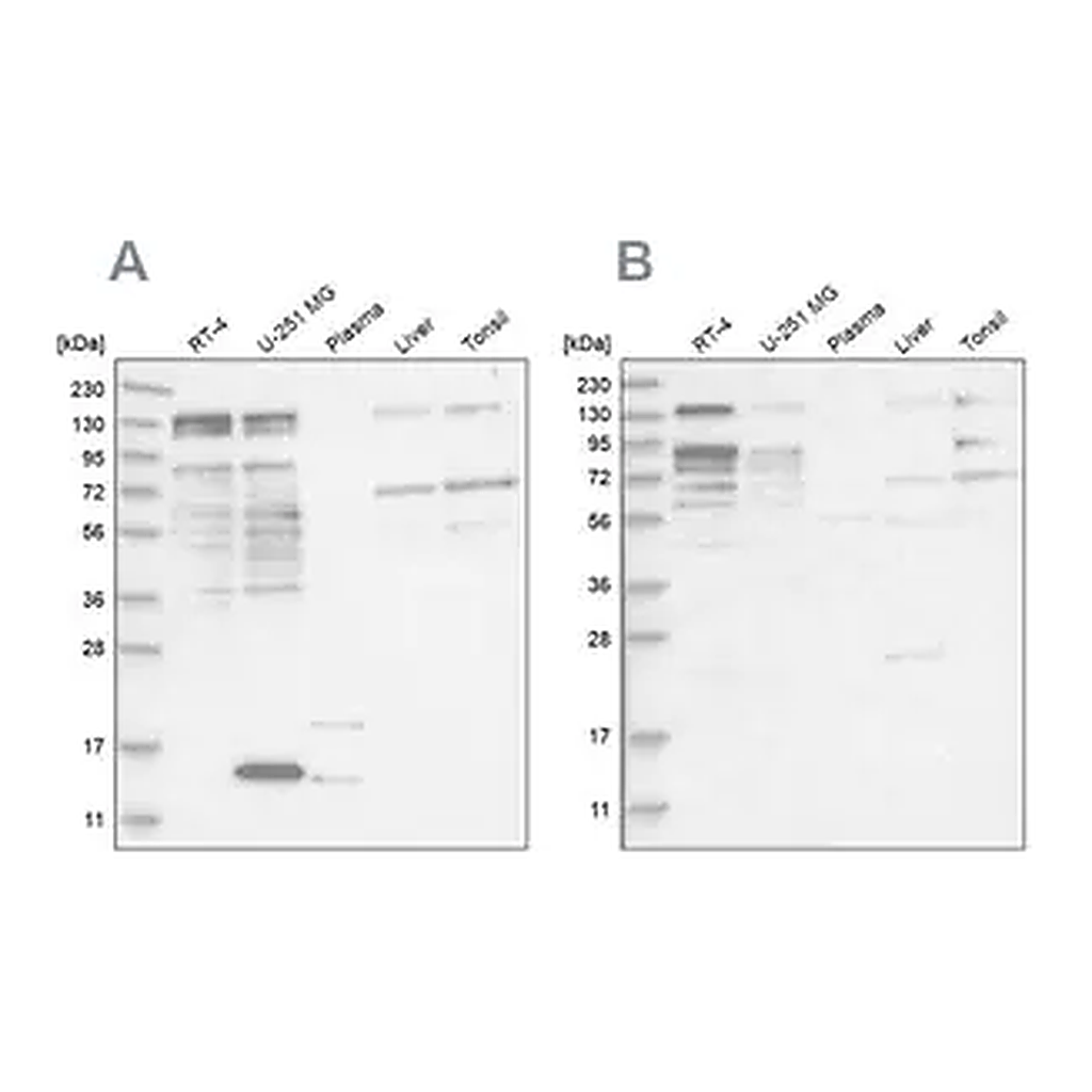 Merck Anti-PUM1 antibody produced in rabbit