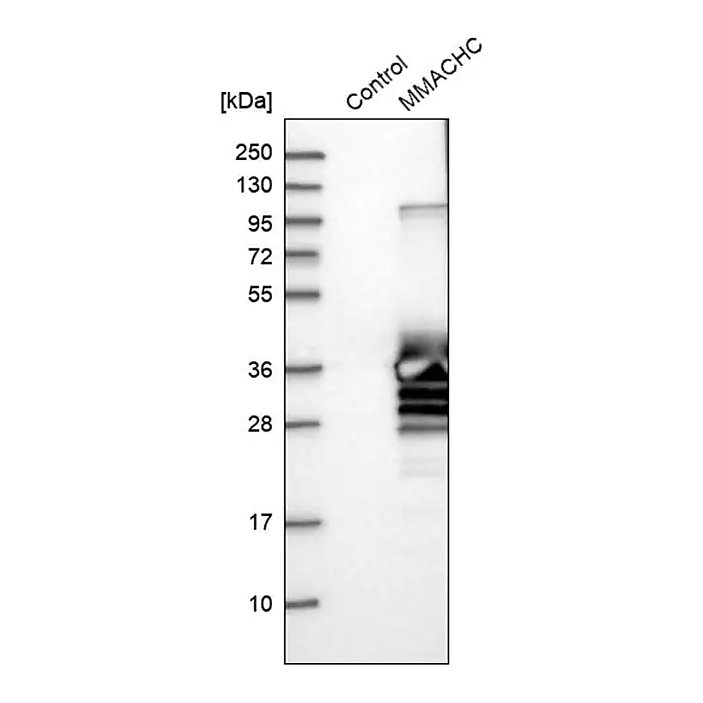Merck Anti-MMACHC antibody produced in rabbit