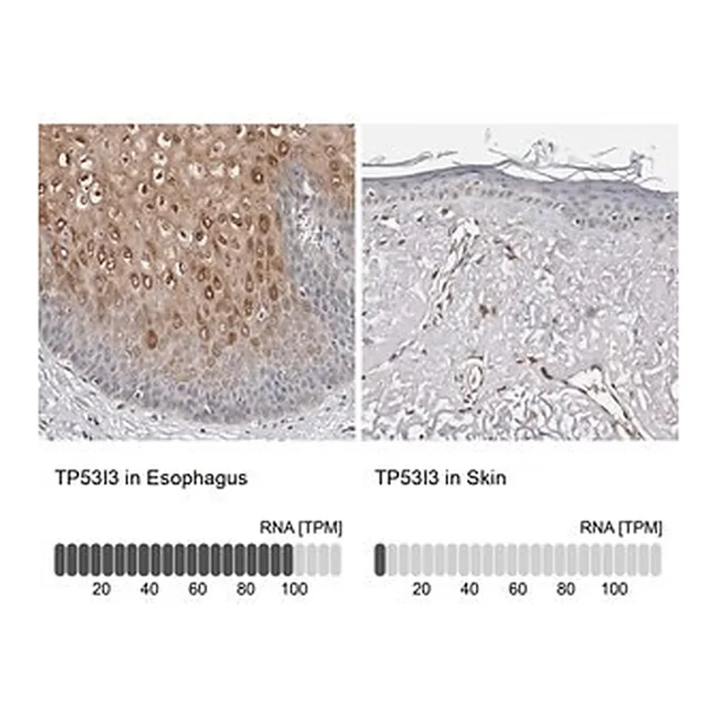 Merck Anti-TP53I3 antibody produced in rabbit