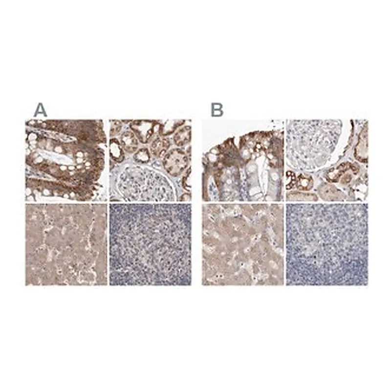 Merck Anti-MRPL18 antibody produced in rabbit