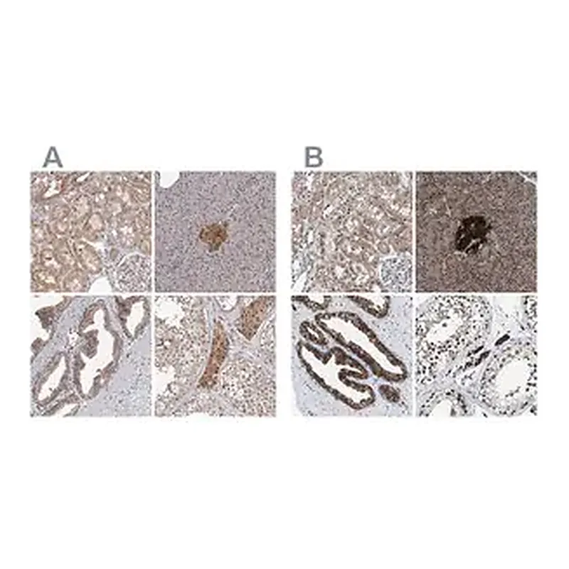 Merck Anti-ACLY antibody produced in rabbit