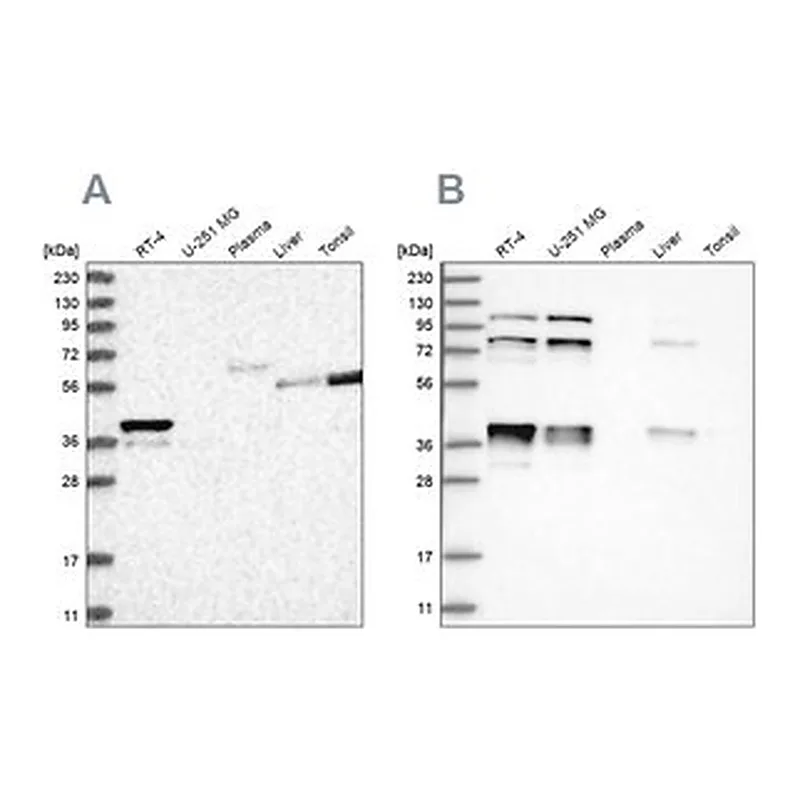 Merck Anti-PLEKHA3 antibody produced in rabbit