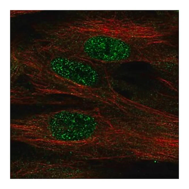 Merck Anti-FOXF1 antibody produced in rabbit
