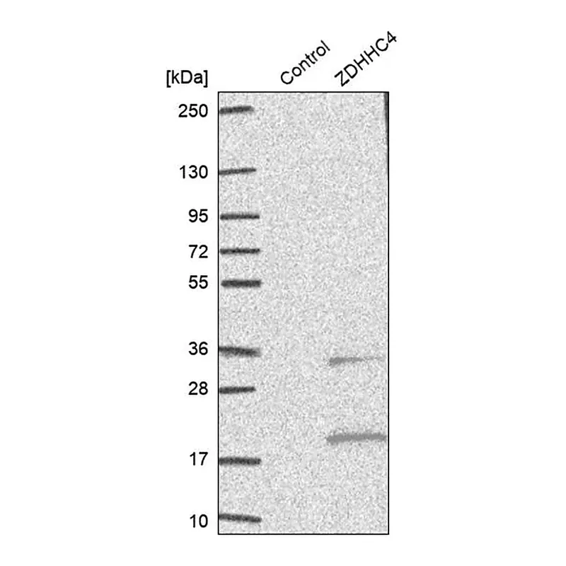 Merck Anti-ZDHHC4 antibody produced in rabbit