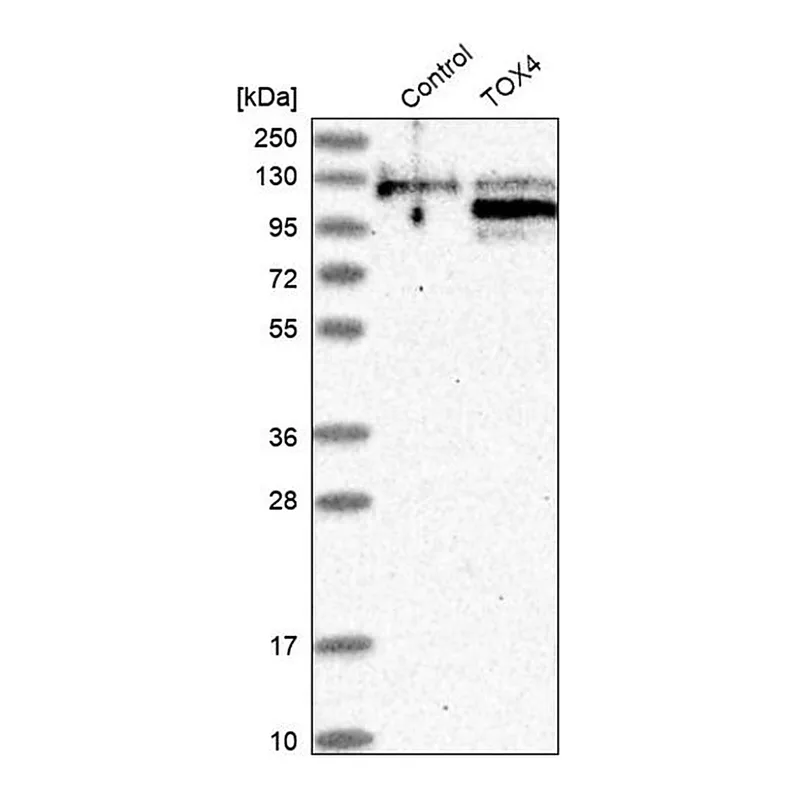 Merck Anti-TOX4 antibody produced in rabbit