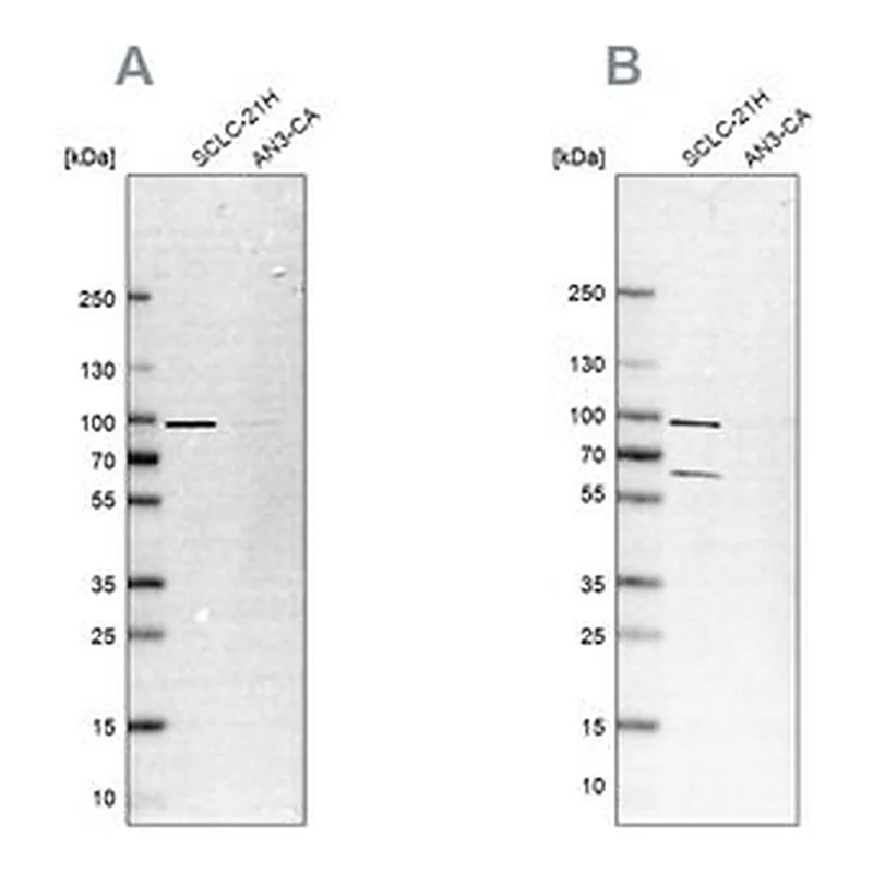 Merck Anti-PNPT1 antibody produced in rabbit