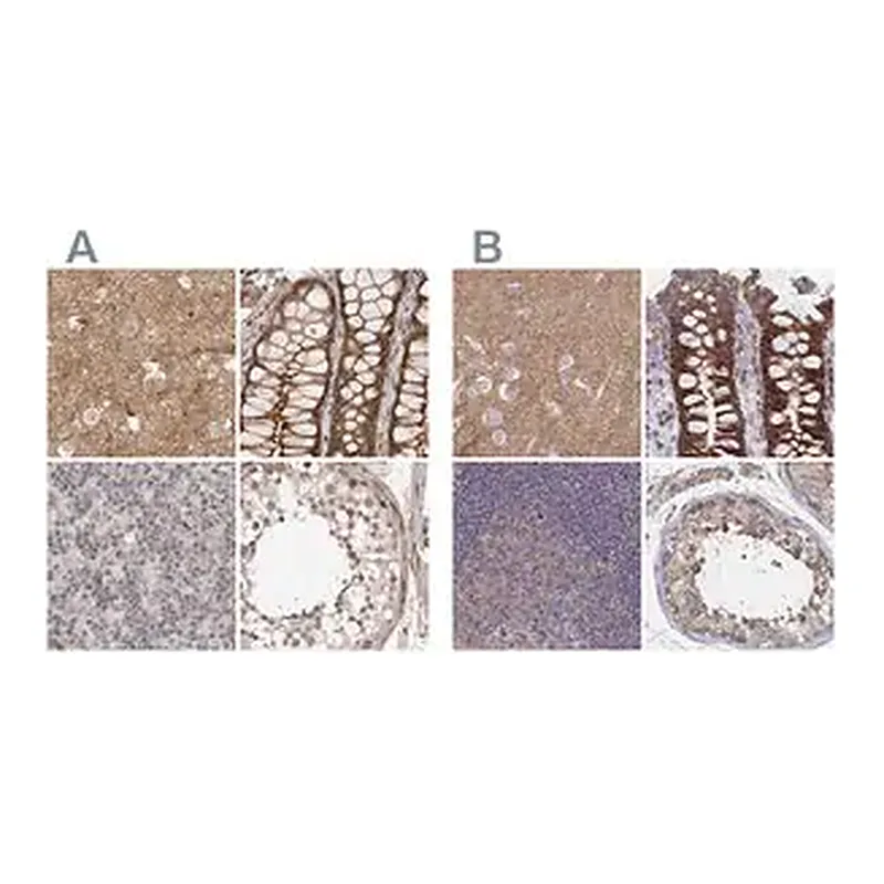 Merck Anti-SORBS1 antibody produced in rabbit