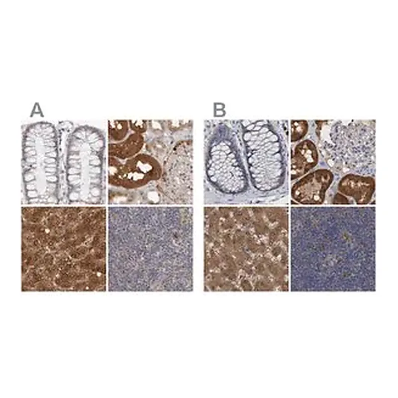Merck Anti-PNPO antibody produced in rabbit
