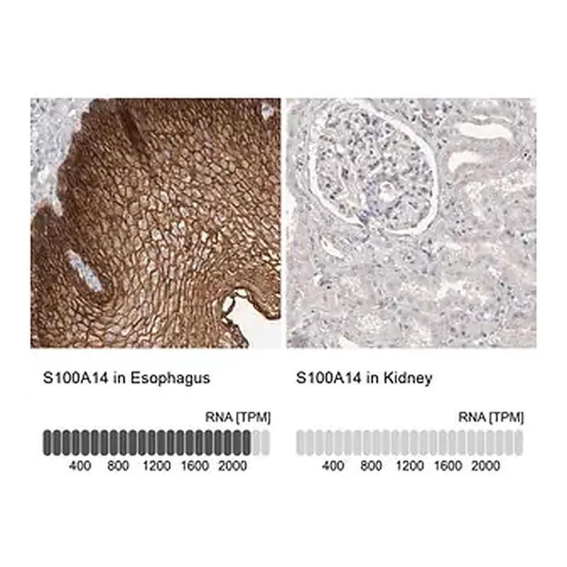 Merck Anti-S100A14 antibody produced in rabbit