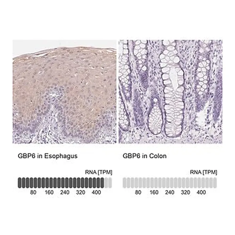 Merck Anti-GBP6 antibody produced in rabbit