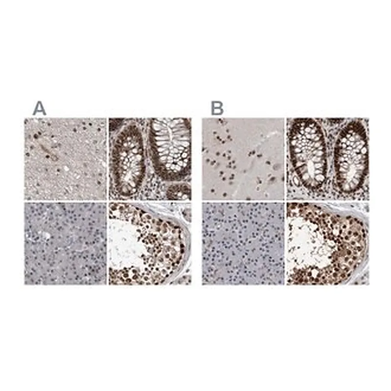 Merck Anti-CHD1L antibody produced in rabbit