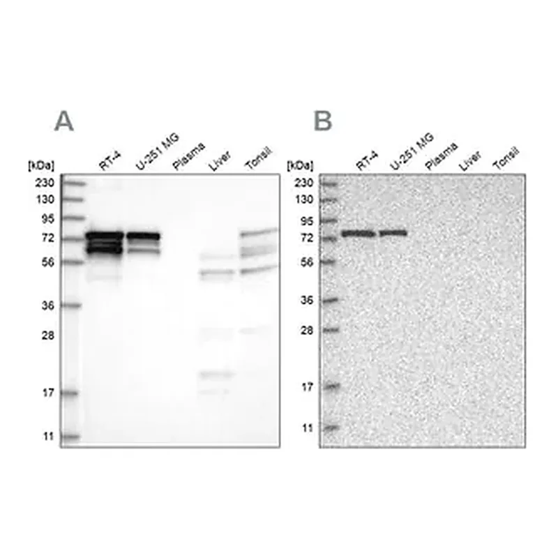 Merck Anti-PPP2R5D antibody produced in rabbit