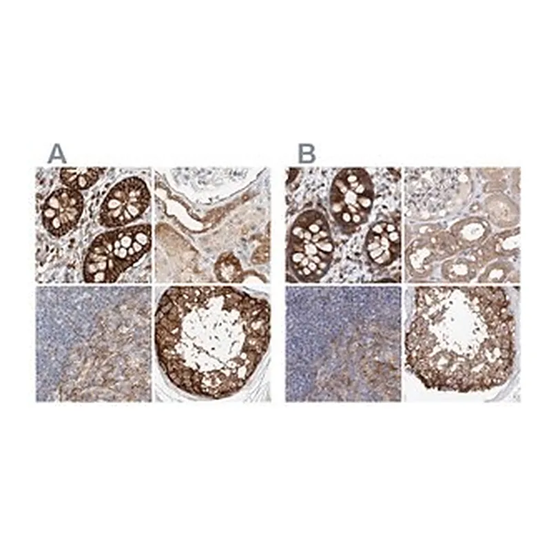 Merck Anti-CARMIL1 antibody produced in rabbit