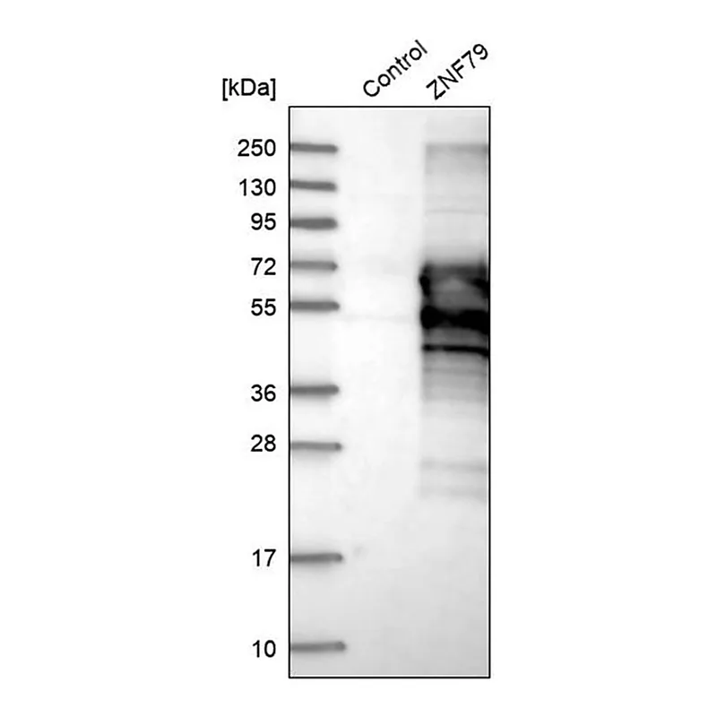 Merck Anti-ZNF79 antibody produced in rabbit