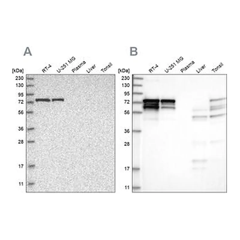 Merck Anti-PPP2R5D antibody produced in rabbit