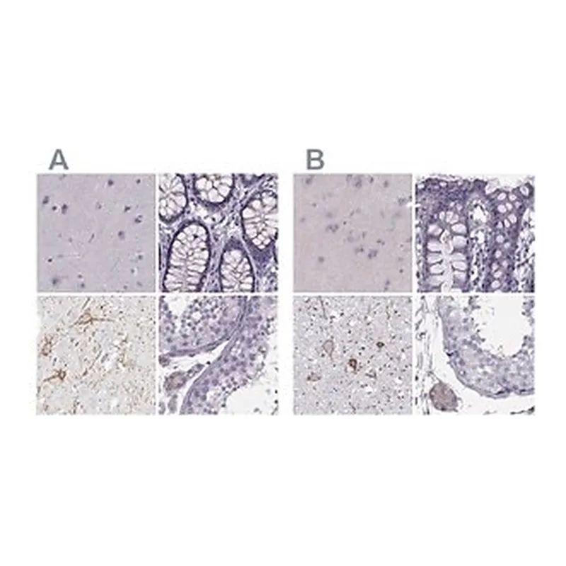 Merck Anti-CALCR antibody produced in rabbit