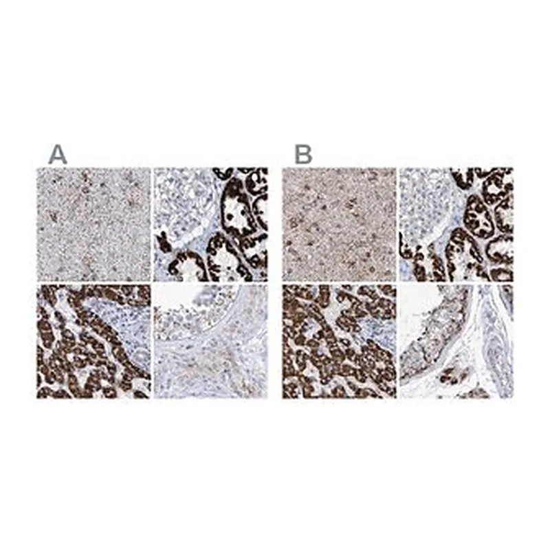 Merck Anti-ALDH6A1 antibody produced in rabbit