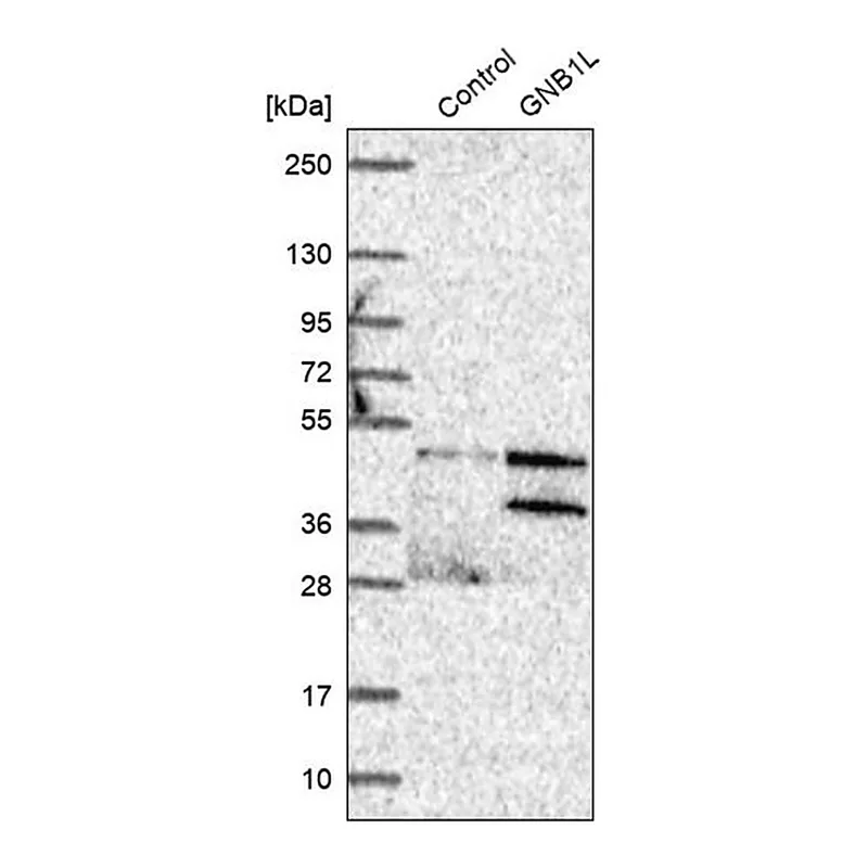 Merck Anti-GNB1L antibody produced in rabbit