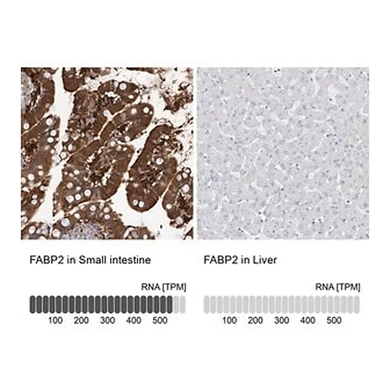 Merck Anti-FABP2 antibody produced in rabbit