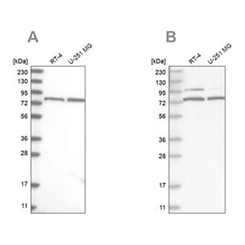 Merck Anti-P2RX7 antibody produced in rabbit