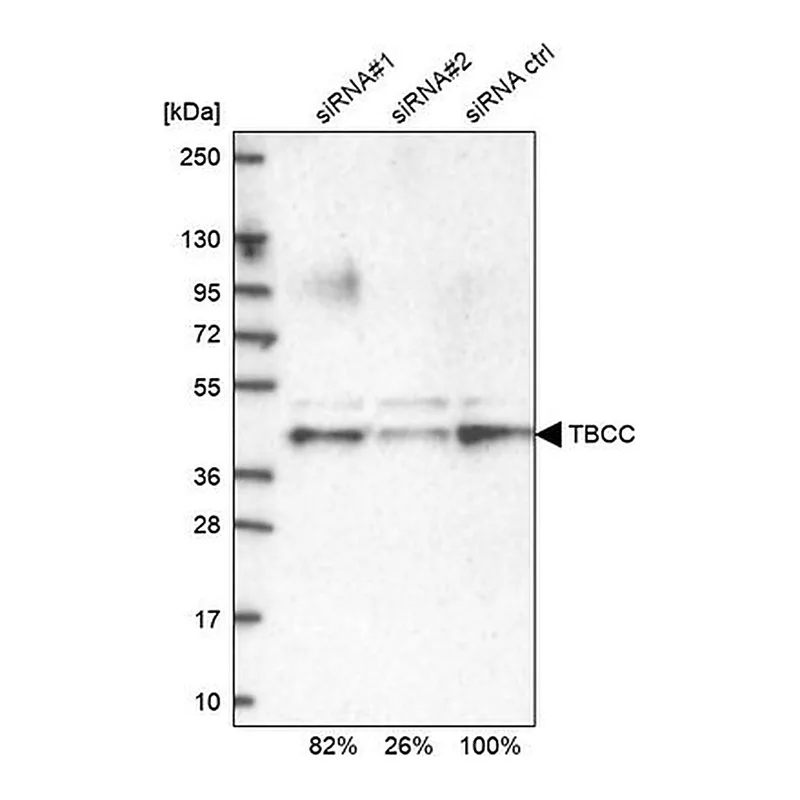 Merck Anti-TBCC antibody produced in rabbit