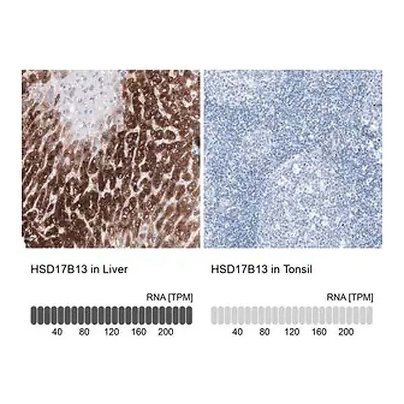 Merck Anti-HSD17B13 antibody produced in rabbit