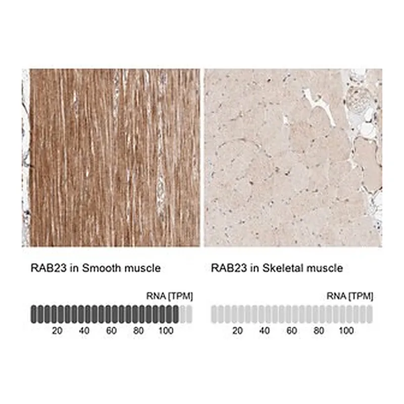 Merck Anti-RAB23 antibody produced in rabbit